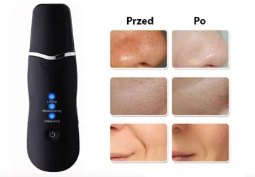 Peeling kawitacyjny do twarzy ultradźwiękowy